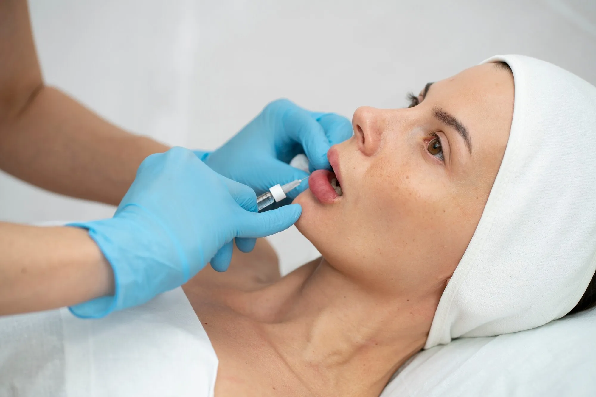 EZ Gel Biofiller in Plainview, NY at Stay Ageless Clinic