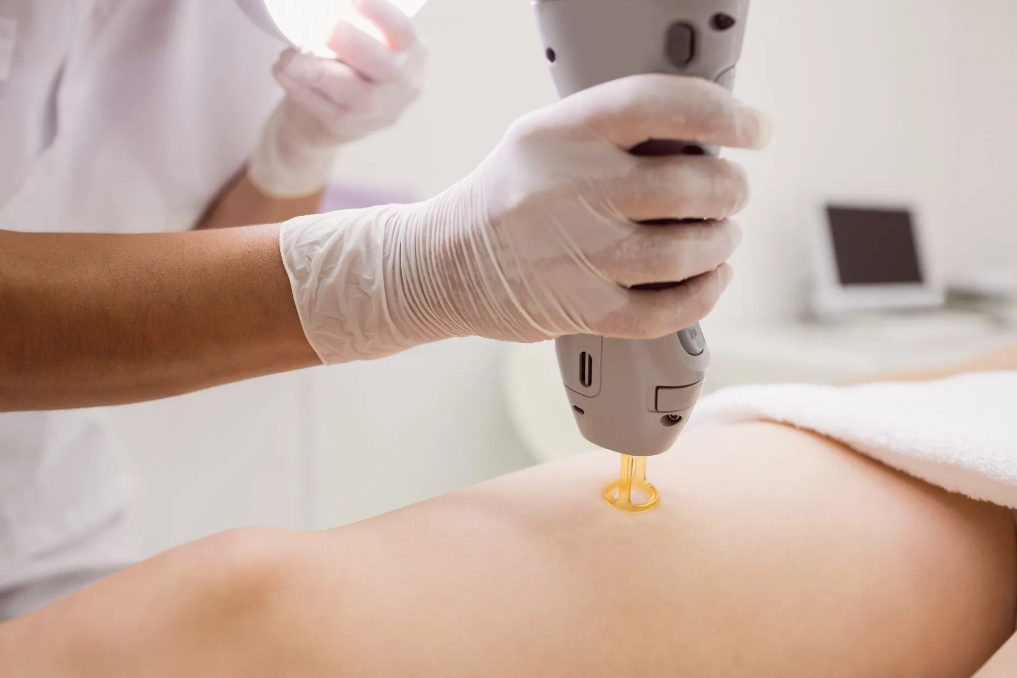 Candela GentleMax Pro laser hair removal for darker skin in Plainview NY