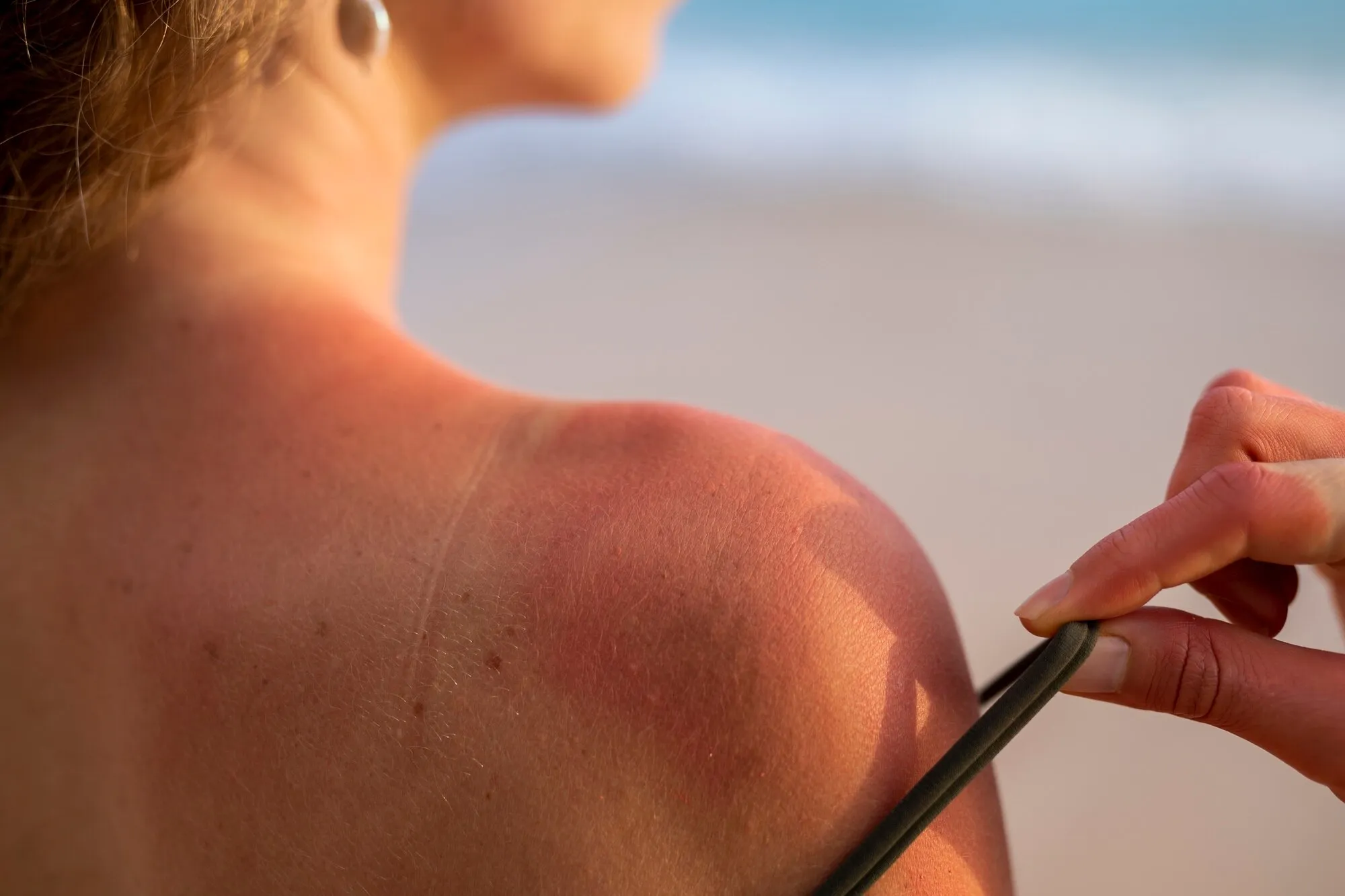 Sun damage and pigmentation consultation at Stay Ageless Clinic in Center Moriches NY