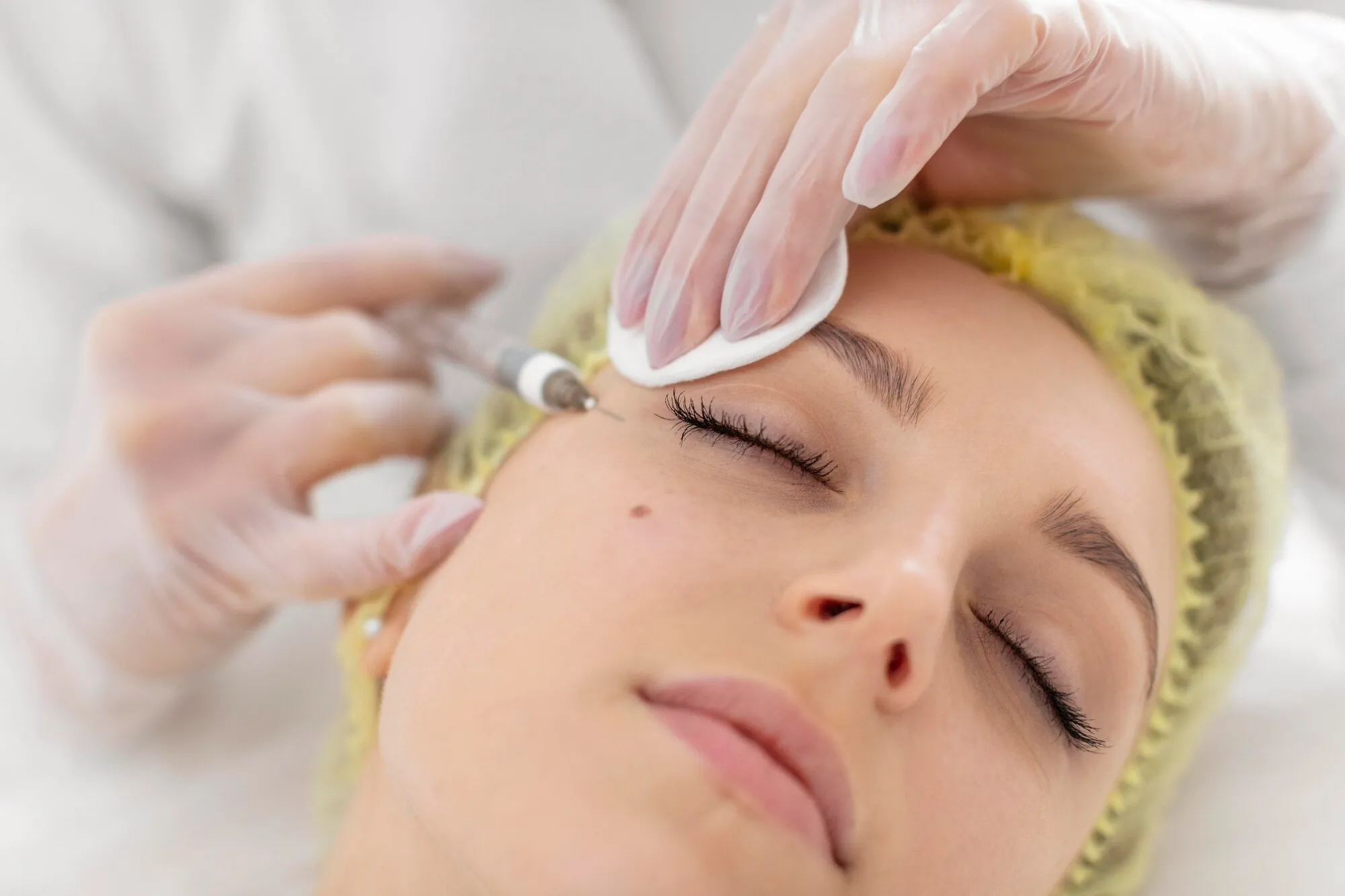 Under-eye PRF treatment in Plainview NY and Center Moriches